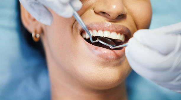 Best Knocked-Out Tooth (Avulsed Tooth) Treatment in Gardende, AL
